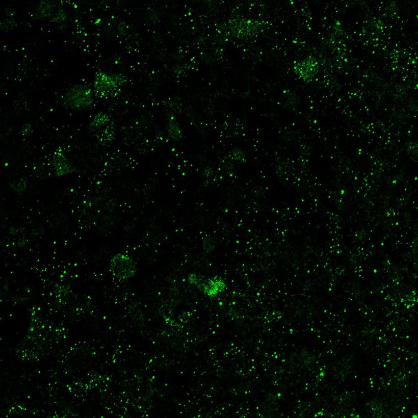 Reporter expression in differentiated airway epithelial cultures (ALI)