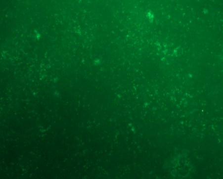 Reporter expression in differentiated airway epithelial cultures (ALI)