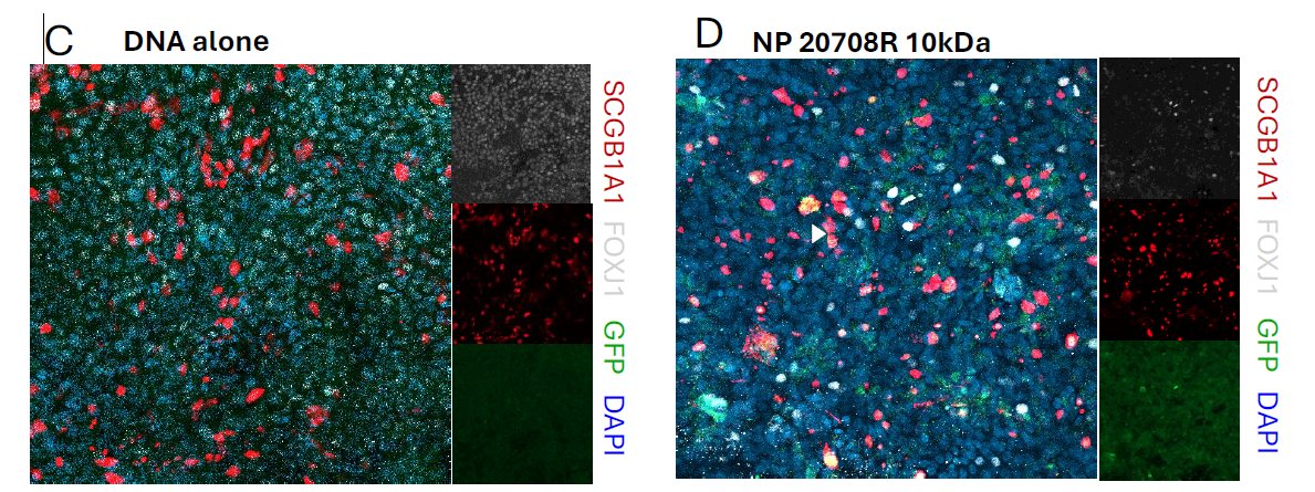 Confocal: ZO-1, FOXJ1, GFP and DAPI in differentiated airway epithelium